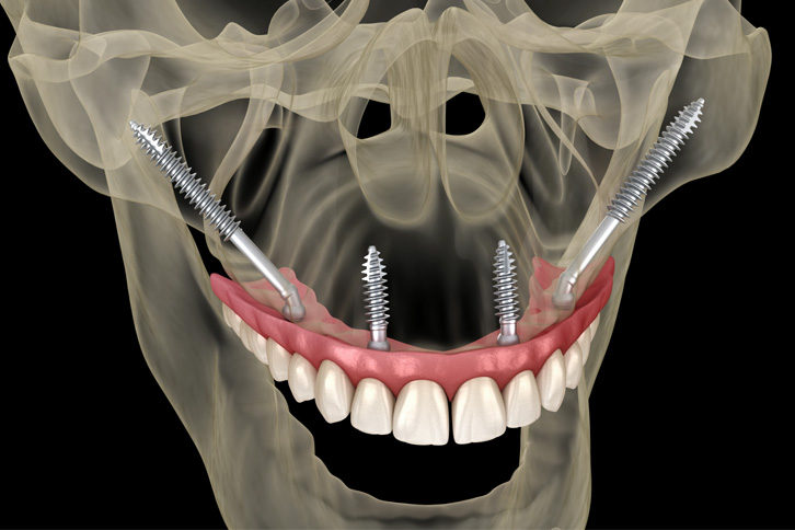 Maxilar: anatomia, principais causas de dor e muito mais