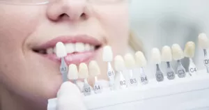 O que é Clareamento Dental
